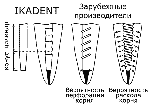 Преимущества титановых штифтов IKADENT (ИКАДЕНТ)